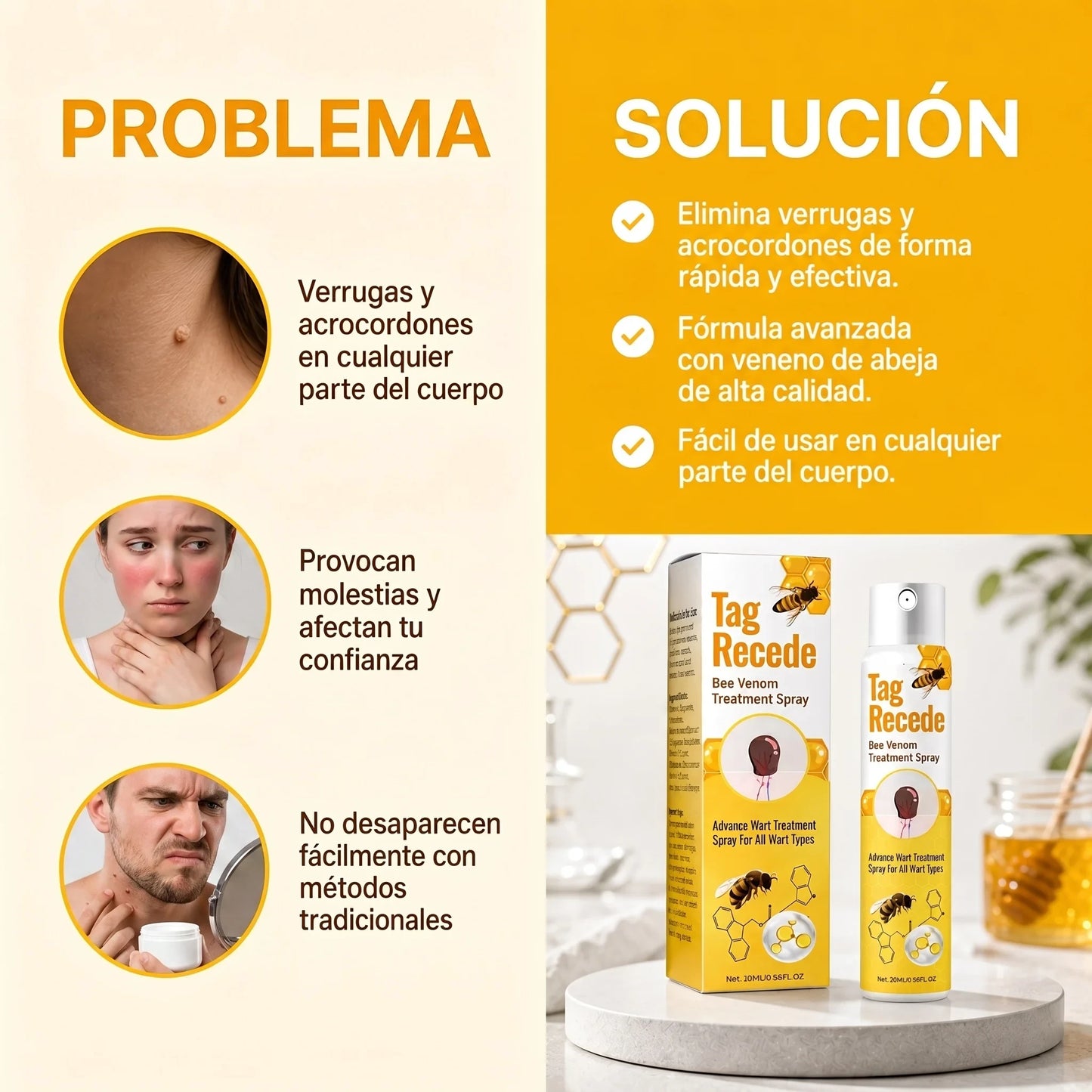 Tag Recede - Elimina Verrugas De Forma Rápida, Segura Y Sin Cicatrices