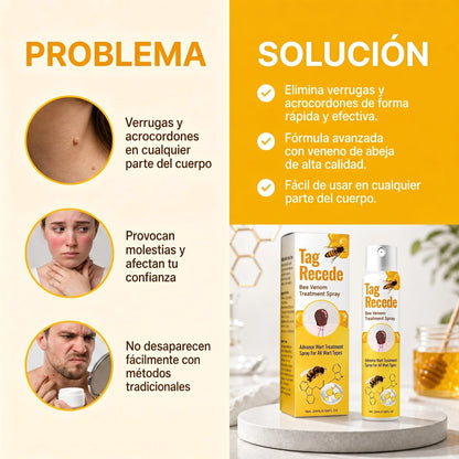 Tag Recede - Elimina Verrugas De Forma Rápida, Segura Y Sin Cicatrices