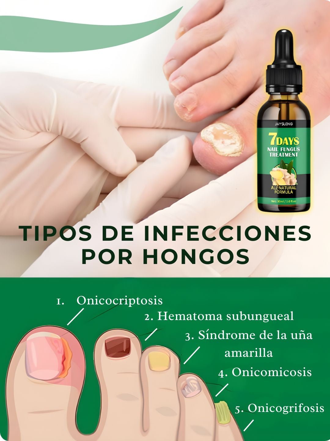 Serum 7 Days | Reparador de Uñas Antihongos - Golden Group Enterprise